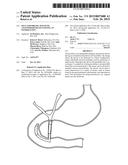 SELF-ASSEMBLING MAGNETIC ANASTOMOSIS DEVICE HAVING AN EXOSKELETON diagram and image