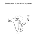 SELF-ASSEMBLING MAGNETIC ANASTOMOSIS DEVICE HAVING AN EXOSKELETON diagram and image