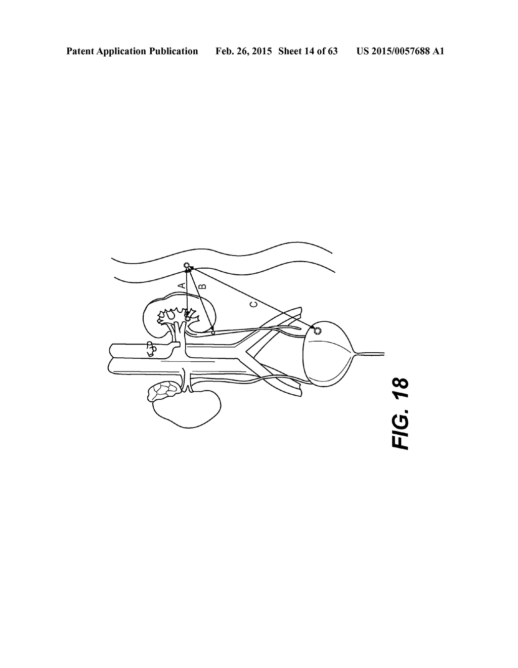 SELF-ASSEMBLING MAGNETIC ANASTOMOSIS DEVICE HAVING AN EXOSKELETON - diagram, schematic, and image 15