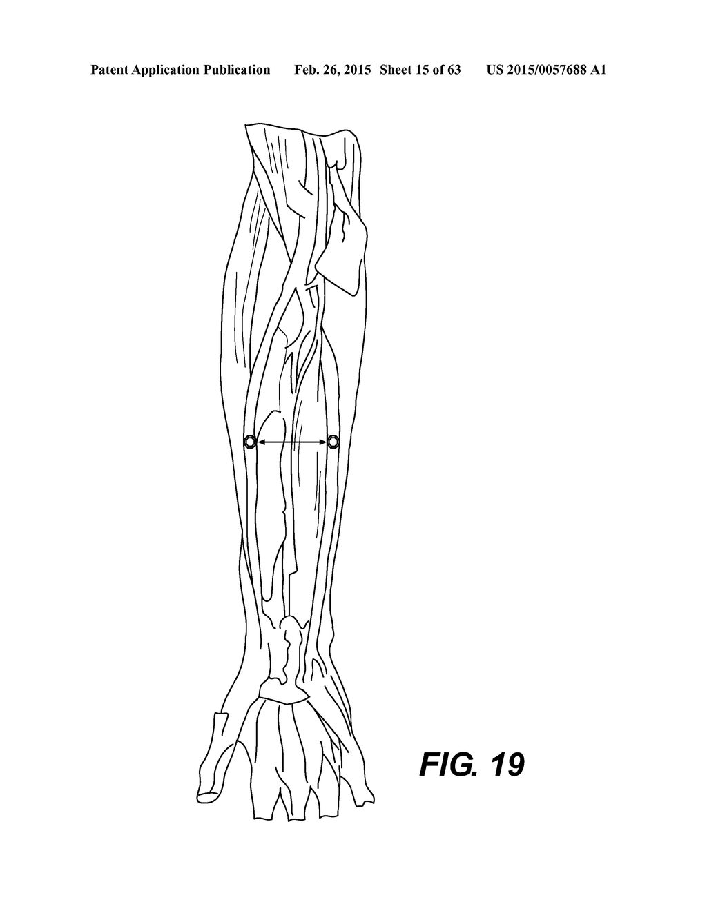 SELF-ASSEMBLING MAGNETIC ANASTOMOSIS DEVICE HAVING AN EXOSKELETON - diagram, schematic, and image 16