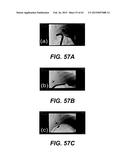 SELF-ASSEMBLING MAGNETIC ANASTOMOSIS DEVICE HAVING AN EXOSKELETON diagram and image