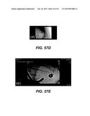 SELF-ASSEMBLING MAGNETIC ANASTOMOSIS DEVICE HAVING AN EXOSKELETON diagram and image