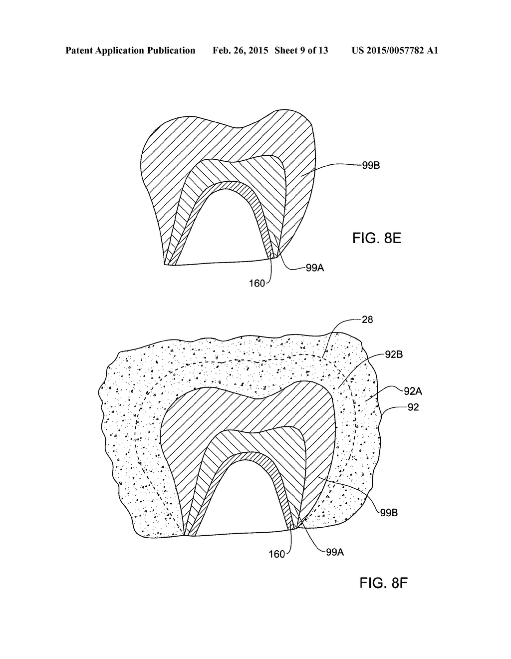 SYSTEM AND METHOD FOR MANUFACTURING A DENTAL PROSTHESIS AND A DENTAL     PROSTHESIS MANUFACTURED THEREBY - diagram, schematic, and image 10