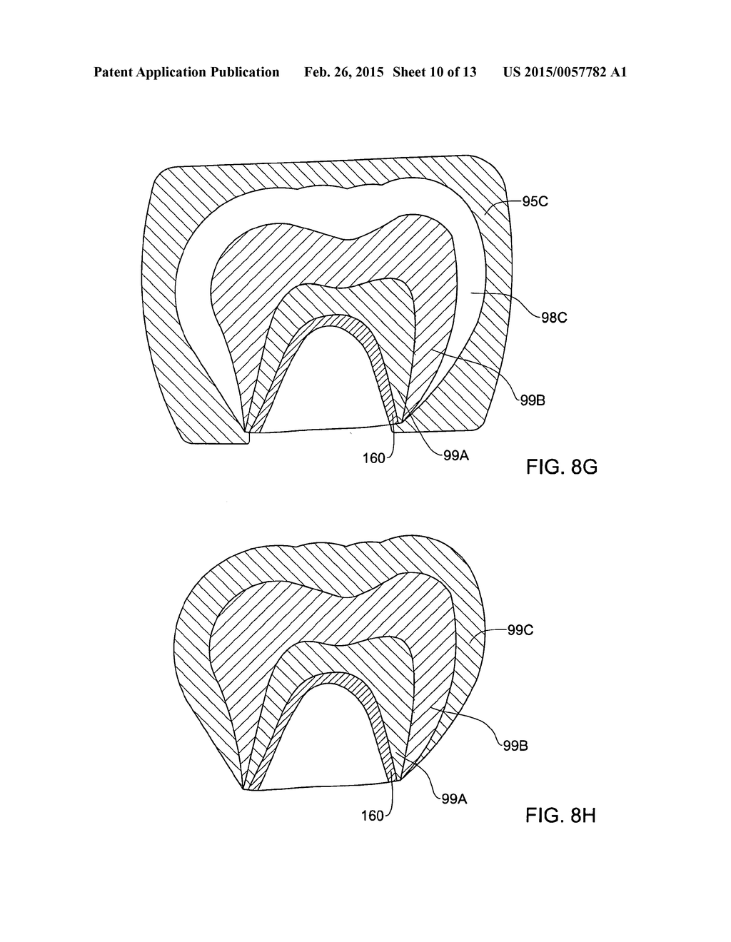 SYSTEM AND METHOD FOR MANUFACTURING A DENTAL PROSTHESIS AND A DENTAL     PROSTHESIS MANUFACTURED THEREBY - diagram, schematic, and image 11