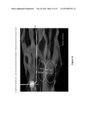 MICROSEISMIC EVENT LOCALIZATION USING BOTH DIRECT-PATH AND HEAD-WAVE     ARRIVALS diagram and image