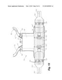 Releasable Vest diagram and image