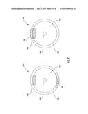 Systems and Methods for Detecting an Imbalanced Load in a Washing Machine     Appliance Having a Balancing Apparatus diagram and image