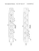 Engine Crankcase Breathing Passage With Flow Diode diagram and image