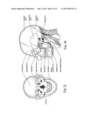 PATIENT INTERFACE diagram and image