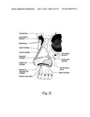 PATIENT INTERFACE diagram and image