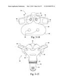 PATIENT INTERFACE diagram and image