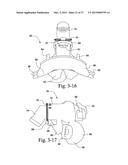 PATIENT INTERFACE diagram and image