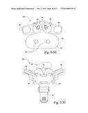 PATIENT INTERFACE diagram and image