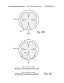 ELECTROPLATING APPARATUS FOR TAILORED UNIFORMITY PROFILE diagram and image