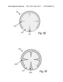 ELECTROPLATING APPARATUS FOR TAILORED UNIFORMITY PROFILE diagram and image