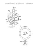 Dual Series Pitch Link Bearing diagram and image