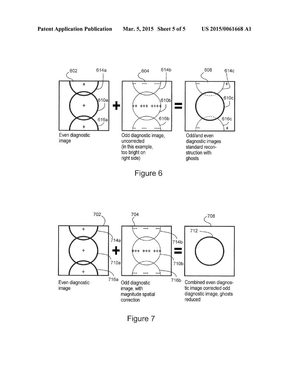 MRI GHOSTING CORRECTION USING UNEQUAL MAGNITUDES RATIO - diagram, schematic, and image 06