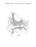 DEVICES FOR ENHANCING TRANSMISSIONS OF STIMULI IN AUDITORY PROSTHESES diagram and image