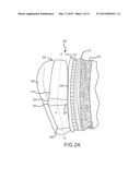 DEVICES FOR ENHANCING TRANSMISSIONS OF STIMULI IN AUDITORY PROSTHESES diagram and image