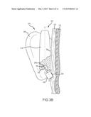 DEVICES FOR ENHANCING TRANSMISSIONS OF STIMULI IN AUDITORY PROSTHESES diagram and image