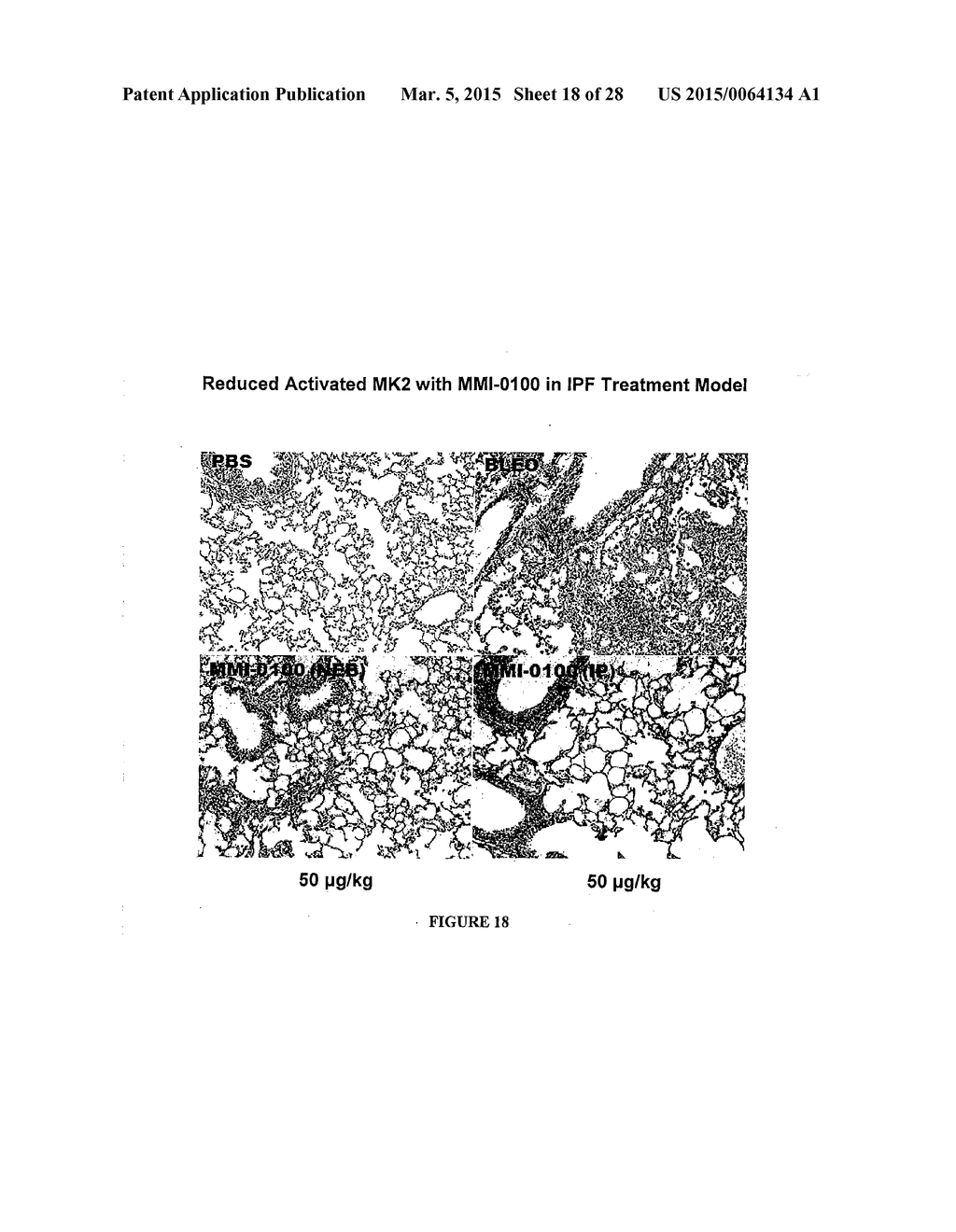 COMPOSITIONS AND METHODS FOR PREVENTING OR TREATING DISEASES, CONDITIONS,     OR PROCESSES CHARACTERIZED BY ABERRANT FIBROBLAST PROLIFERATION AND     EXTRACELLULAR MATRIX DEPOSITION - diagram, schematic, and image 19