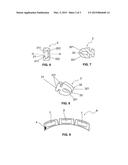 VIBRATING ORTHODONTIC DEVICE diagram and image