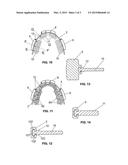 VIBRATING ORTHODONTIC DEVICE diagram and image