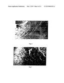 NEUREGULIN BASED METHODS AND COMPOSITIONS FOR TREATING CARDIOVASCULAR     DISEASES diagram and image