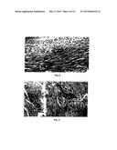 NEUREGULIN BASED METHODS AND COMPOSITIONS FOR TREATING CARDIOVASCULAR     DISEASES diagram and image