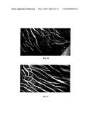 NEUREGULIN BASED METHODS AND COMPOSITIONS FOR TREATING CARDIOVASCULAR     DISEASES diagram and image