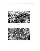 NEUREGULIN BASED METHODS AND COMPOSITIONS FOR TREATING CARDIOVASCULAR     DISEASES diagram and image