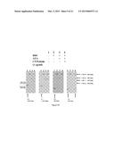 TREATMENT OF AGE-RELATED MACULAR DEGENERATION diagram and image