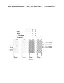 TREATMENT OF AGE-RELATED MACULAR DEGENERATION diagram and image