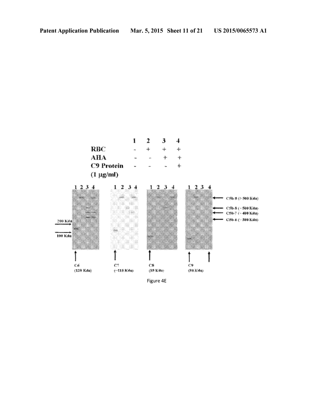 TREATMENT OF AGE-RELATED MACULAR DEGENERATION - diagram, schematic, and image 12