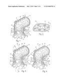 METHOD FOR TREATING FECAL INCONTINENCE diagram and image