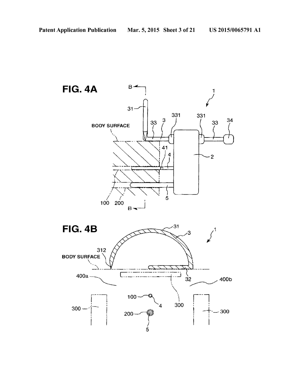 PUNCTURE APPARATUS - diagram, schematic, and image 04