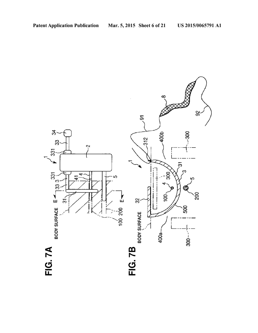 PUNCTURE APPARATUS - diagram, schematic, and image 07