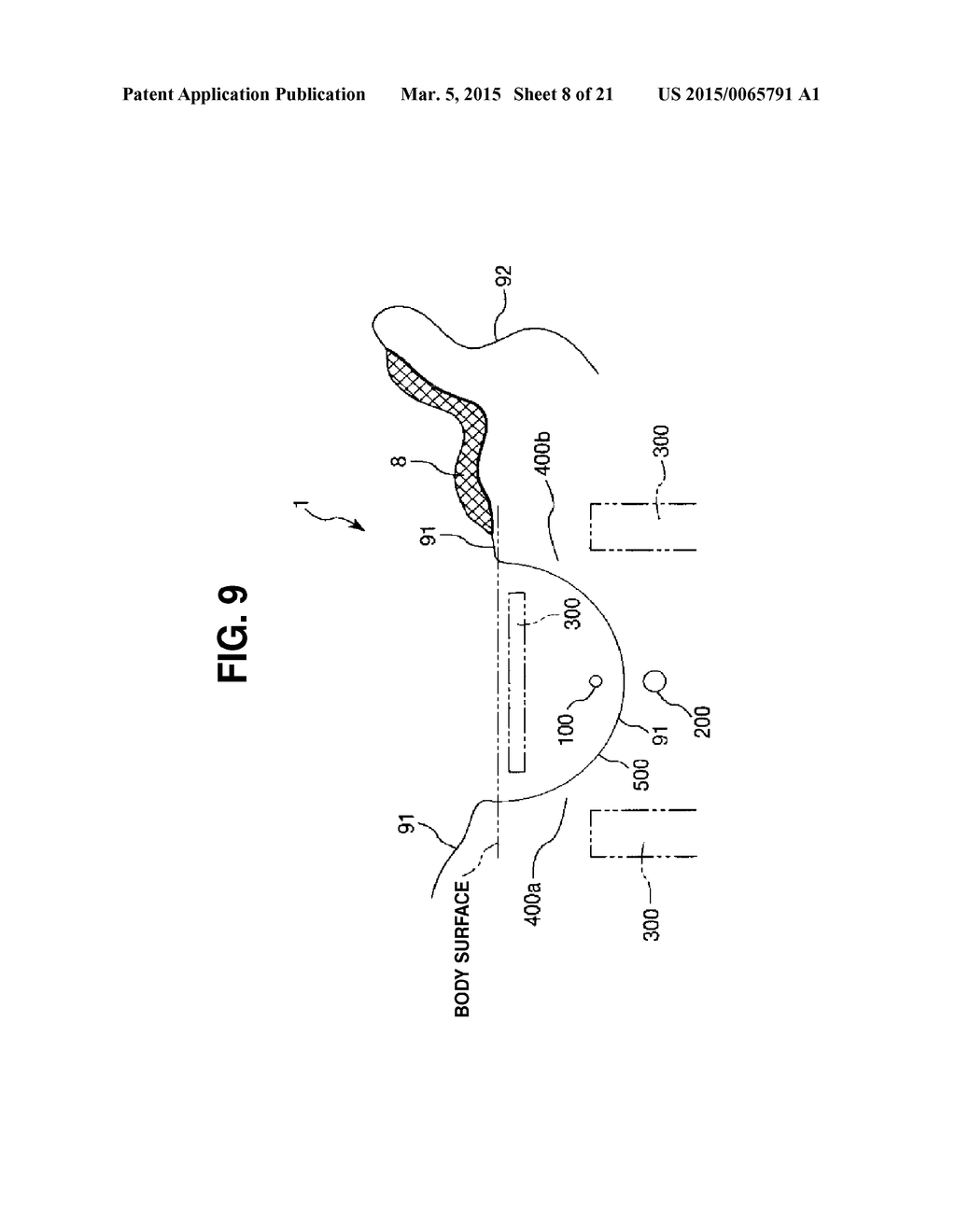 PUNCTURE APPARATUS - diagram, schematic, and image 09