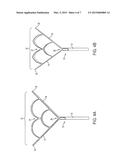 SURGICAL RETRACTOR diagram and image