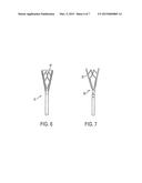 SURGICAL RETRACTOR diagram and image