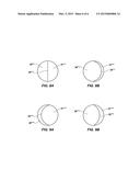 DOUBLE LUMEN ARTHROSCOPY PORT diagram and image