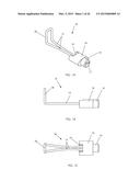 IRIS RETRACTOR diagram and image