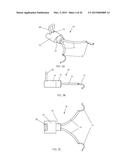 IRIS RETRACTOR diagram and image