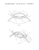 IRIS RETRACTOR diagram and image