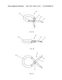 IRIS RETRACTOR diagram and image