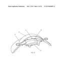 IRIS RETRACTOR diagram and image