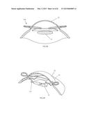 IRIS RETRACTOR diagram and image