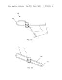 IRIS RETRACTOR diagram and image