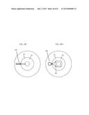 IRIS RETRACTOR diagram and image