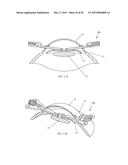 IRIS RETRACTOR diagram and image